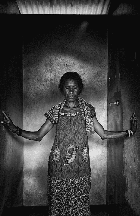 Die Arnsberger Ausstellung setzt sich auch mit Hexenverfolgung im 21. Jahrhundert auseinander. Hier: Opfer einer Hexenjagd in Papua-Neuguinea, 2018 - Foto Bettina Flitner