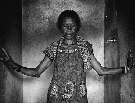 Die Arnsberger Ausstellung setzt sich auch mit Hexenverfolgung im 21. Jahrhundert auseinander. Hier: Opfer einer Hexenjagd in Papua-Neuguinea, 2018 - Foto Bettina Flitner