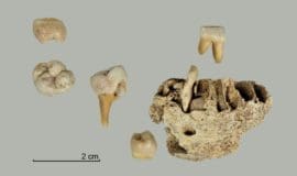 Unterkiefer eines siebenjährigen Kindes sowie die dazugehörigen Zähne. Foto: LWL
